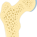 Pilates and Osteoporosis: Latest Research and Great Modifications 1 Pilates and Osteoporosis femoral neck